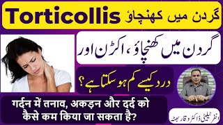 Torticollis گردن میں کھنچاؤ मन्यास्तंभ Homeopathic Treatmennt By Dr Waqar Bhutta In Urdu  Hindi [upl. by Aleik]