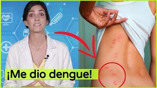 ¡Me dio dengue [upl. by Siouxie]