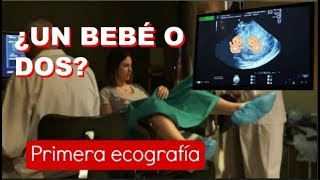 PRIMERA ECOGRAFÍA 6 SEMANAS EMBARAZO  Latido cardiaco ¿Un bebé o dos ¿GEMELOS [upl. by Deenya]