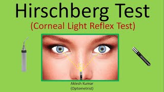 Hirschberg Test  Corneal Light Reflex Test  CLR  HBRT [upl. by Oigufer516]