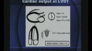 Basics Of Echocardiography Part2series2 [upl. by Len]