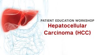 Workshop  Hepatocellular Carcinoma HCC [upl. by Rednal]