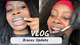 Braces Appointment Its the end of this braces journey  Progress check Vlog adultbraces [upl. by Darnall]