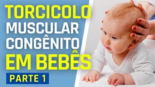 TORCICOLO MUSCULAR CONGÊNITO EM BEBÊS  PARTE 1 [upl. by O'Grady]