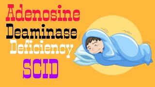 Adenosine Deaminase Deficiency  SCID  Lecture 8 [upl. by Helfand774]