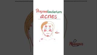 Propionibacterium acnes  Acne Vulgaris  Microbiology science microbiology nurse doctor mbbs [upl. by Brear530]