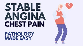 Stable Angina l Chest Pain l Pathology Made Easy [upl. by Anay3]