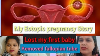 My Ectopic pregnancy story  Lost my first baby meri death bhi ho skti thi  Emergency operation [upl. by Ciel]