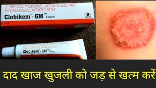 Clobikem Gm Cream Uses in Hindi [upl. by Zimmermann]