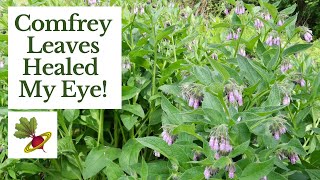 Comfrey Leaves Healed My Eye [upl. by Bille]