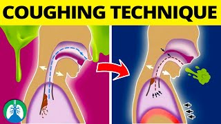 This COUGHING Technique Can Help Get Rid of Mucus and Phlegm ❗ [upl. by Towers933]