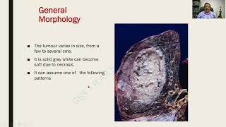 Bronchogenic Carcinoma Part I  Respiratory Pathology  RATS [upl. by Palladin]