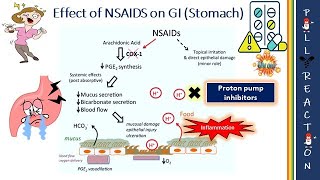 NSAIDs and Peptic Ulcer  Side effects  Gastric Bleeding  Kidney Injury [upl. by Trinee]