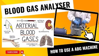 Blood Gas Analyzers  How to use a Blood Gas Analyser [upl. by Miksen]