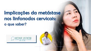 Implicações da metástase nos linfonodos cervicais o que saber  Dr Arthur Vicentini CRM 154086 [upl. by Yetnom290]