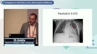 C Kotidis  Hypertrophic cardiomyopathy in children and adolescents Exercise recommendations [upl. by Attebasile]