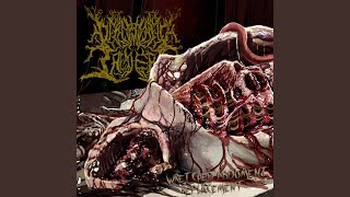 Wretched Abdoment Replacement feat Cephalotripsy [upl. by Ybba151]