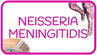 NEISSERIA MENINGITIDIS  meningococemia Sx de Waterhouse Friderichsen CID meningitis síntomas [upl. by Ahsiyt]