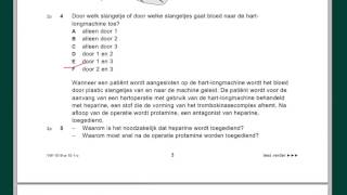 VWO biologie Examenuitleg 2010 tijdvak 1 vr 15 en 2835 deel 1 [upl. by Wandie913]