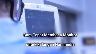 cara tepat membaca monitor [upl. by Eudosia296]