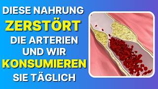 DIESES NAHRUNGSMITTEL ZERSTÖRT DIE ARTERIEN UND WIR ESSEN ES TÄGLICH 🆘 [upl. by Aneerol854]