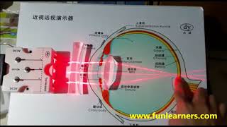 long sightedness and short sightedness demo [upl. by Chapel914]