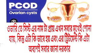 Discussion of PCOD ampPCOSডিম্বাসয় বা ওভারি তে সিস্টcausesHomeopathy Treatment how to prevent [upl. by Fasto]